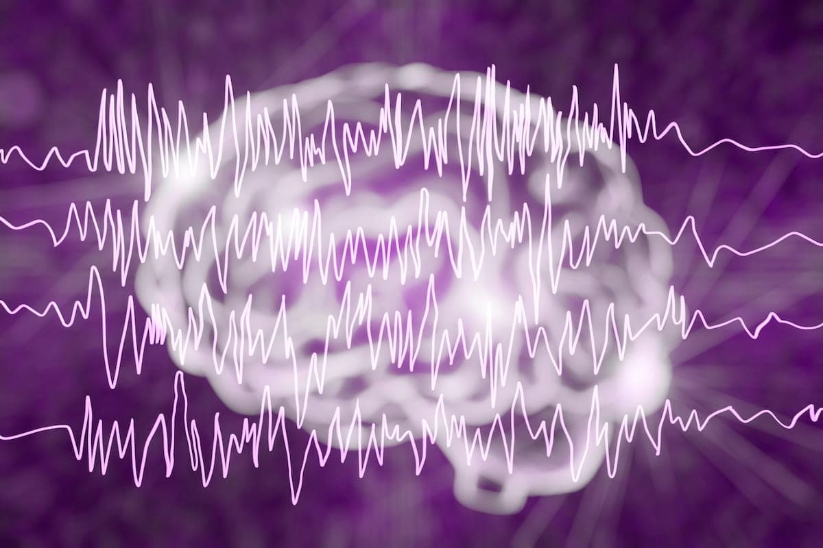 medical cannabis epilepsy