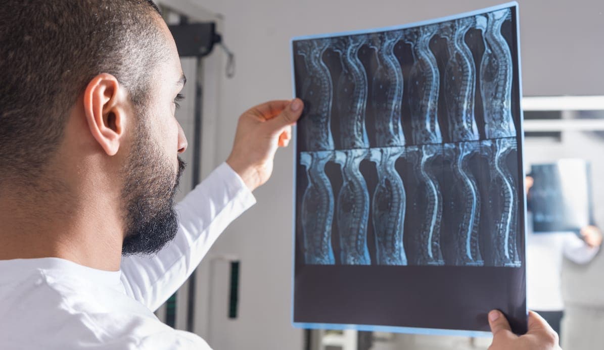 spinal cord injury