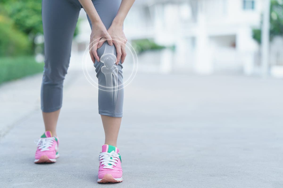 woman with arthritis