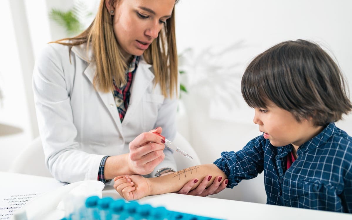 peanut allergy skin prick test