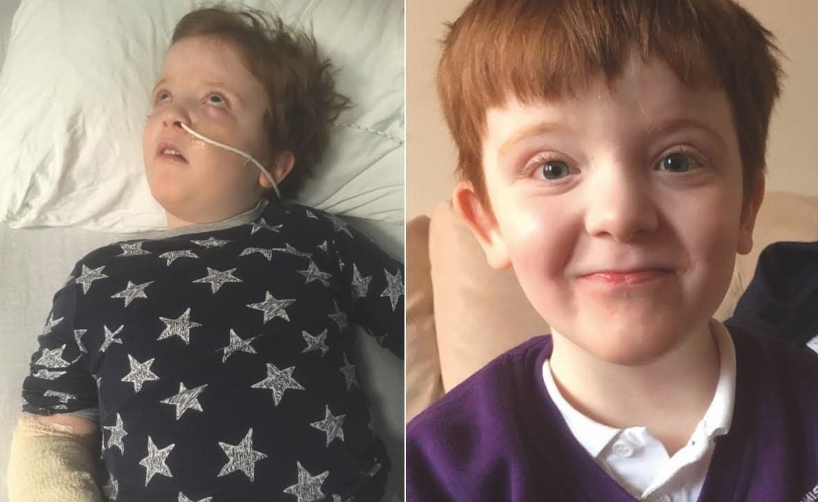 Why the NHS trials won't help the children relying on medical cannabis now