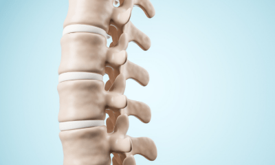 Spine-related pain: A white skeleton spine against a blue background