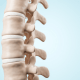 Spine-related pain: A white skeleton spine against a blue background