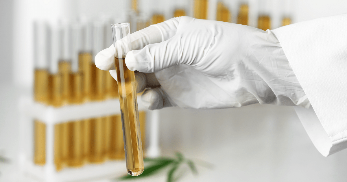 Athletes: A row of test tubes containing CBGA oil with a doctors white gloved hand holding one up to the light