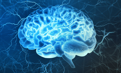 Dystonia: A blue brain lit up by a blue light to highlight parkinsons disease