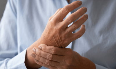 Arthritis pain: A woman holding her hands