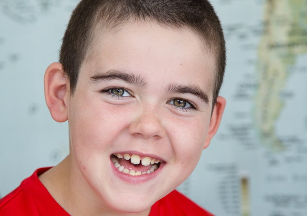 Alfie Dingley celebrates two years seizure free with medical cannabis